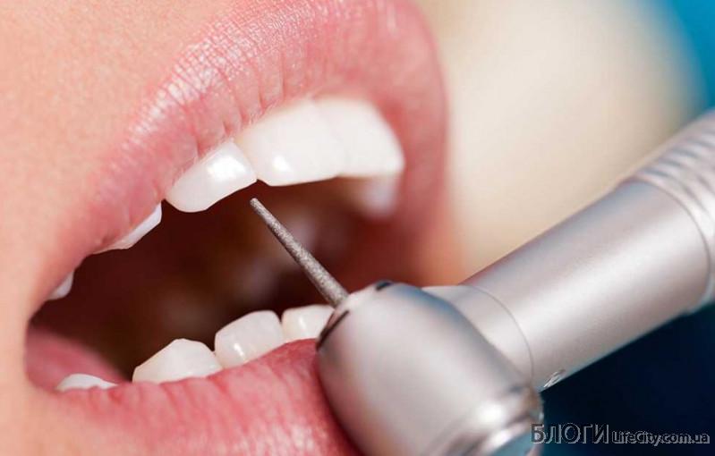 На що здатна естетична стоматологія?