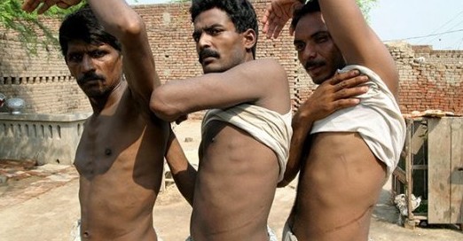 В Индии бедняки продавали свои почки по 7 000 $