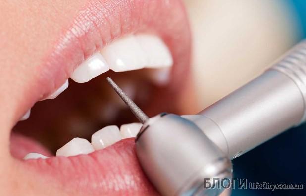 В чём преимущества эстетической стоматологии?