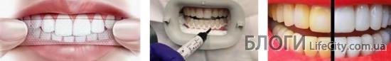 С помощью каких способов отбеливаются зубы человека?
