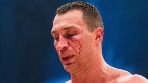 Украинского боксера исключили из IBF